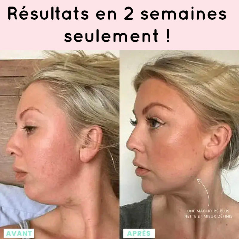 Résultat appareil anti-âge visage