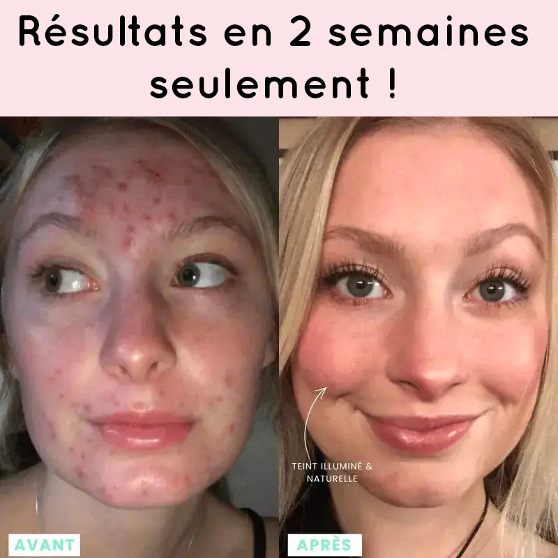 Résultat appareil anti-âge visage