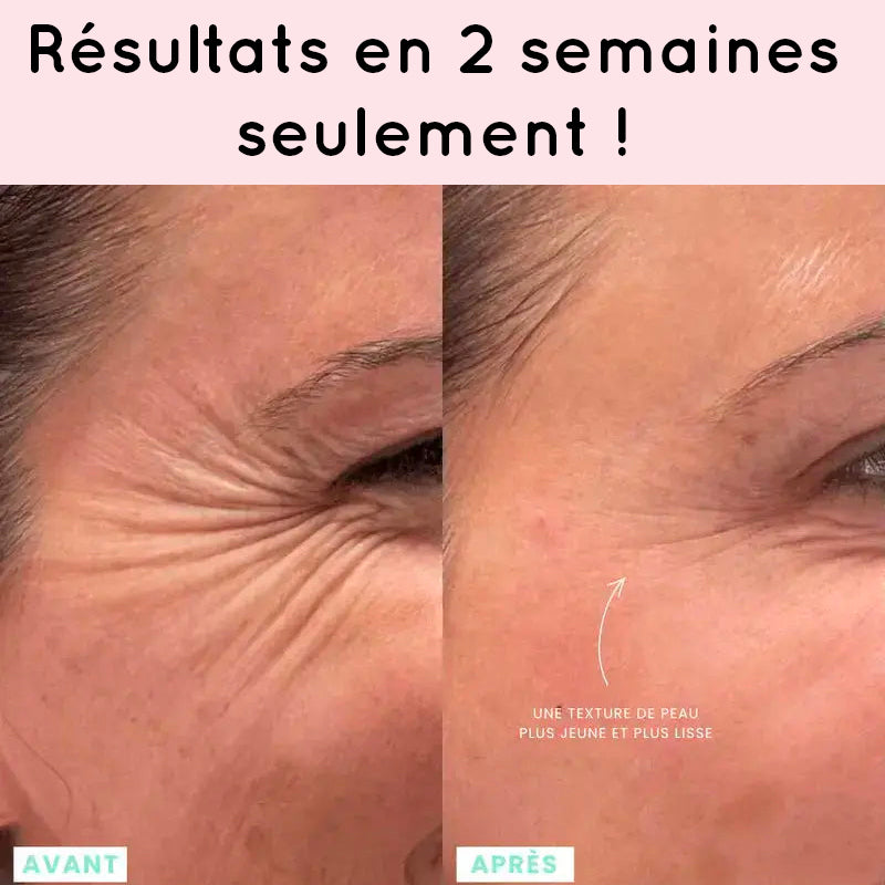 Résultat appareil anti-âge visage